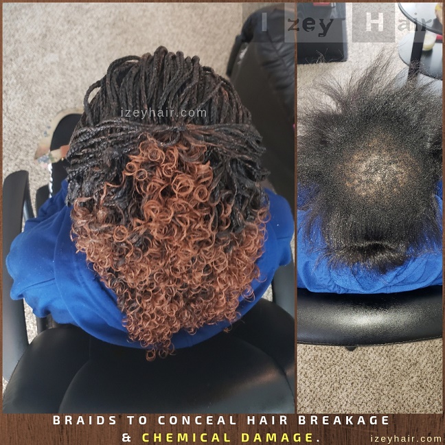 Braids to Conceal Hair Breakage and Chemical Damage.