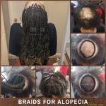 Braids for Alopecia