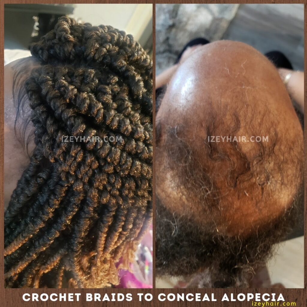 Crochet Braids Spring Twists to Conceal Alopecia Hair Loss