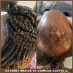 Crochet Braids - Crochet Spring Twists to Conceal Alopecia ~ Hair Loss