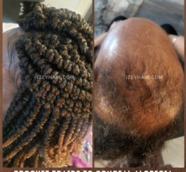 Crochet Braids - Crochet Spring Twists to Conceal Alopecia ~ Hair Loss