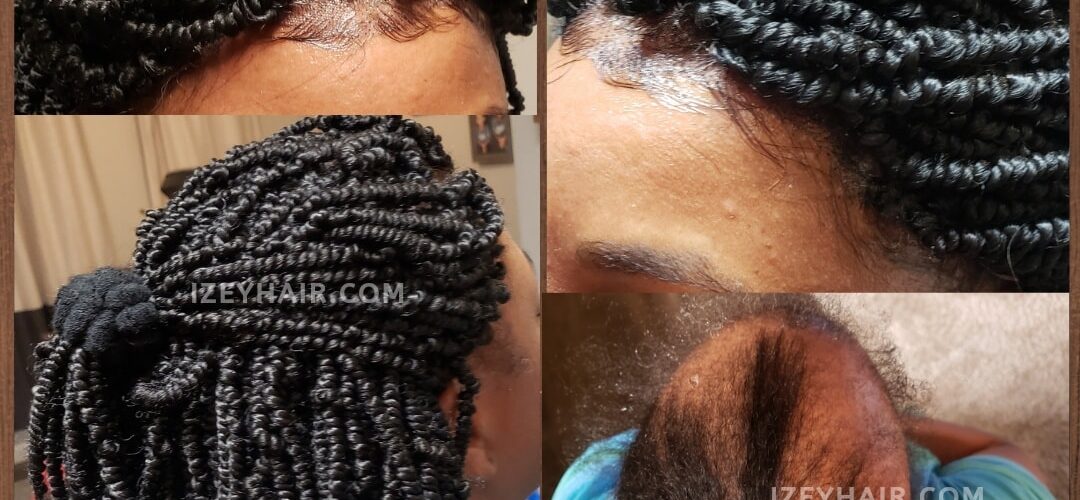Afro Hair: Types, Haircare, Hair Loss Advice - Wimpole Clinic