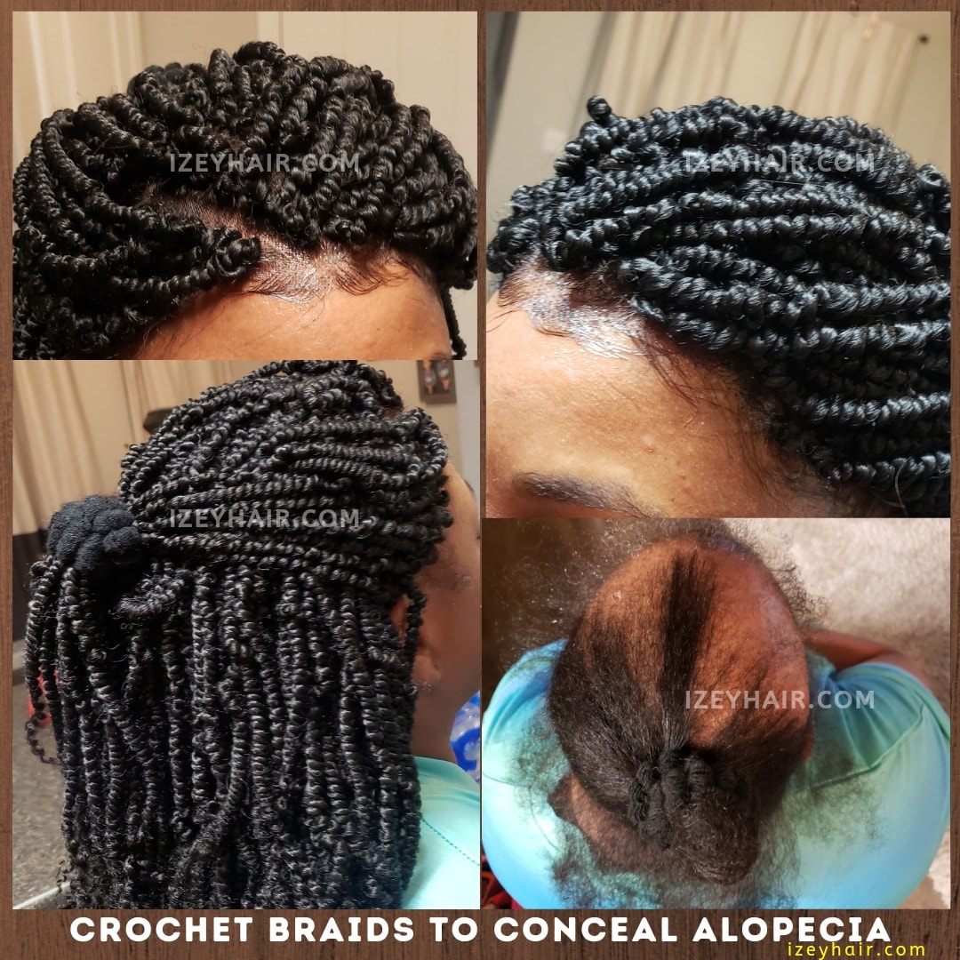 Passion Twist Crochet Braid Style to Conceal Alopecia Hair Loss