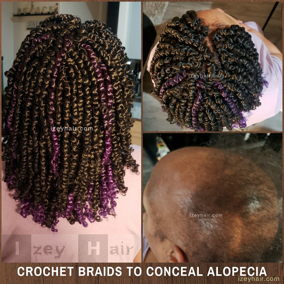 Alopecia Crochet Box Braids
