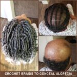 Alopecia Crochet Box Braids