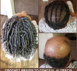 Alopecia Crochet Box Braids