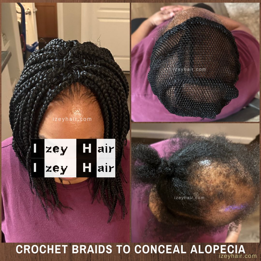 Alopecia Crochet Box Braids