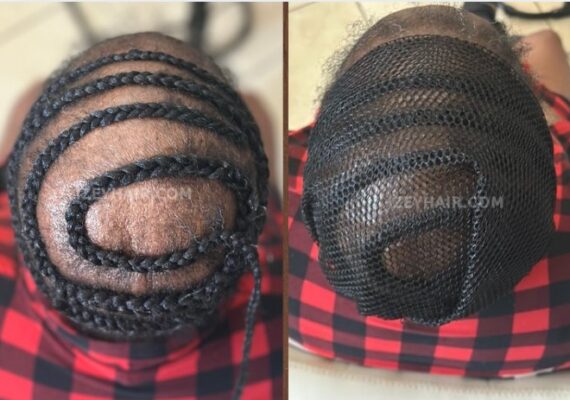 Breathable Net for Alopecia