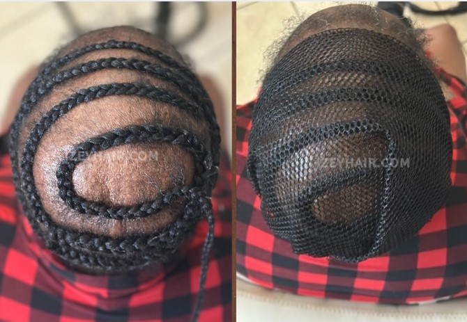 Breathable Net for Alopecia