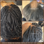 Crochet Braids for Alopecia Installed with Net and Closure