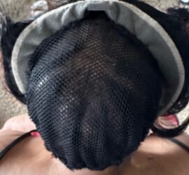 Net and Lace Closure Sew-Ins for Alopecia
