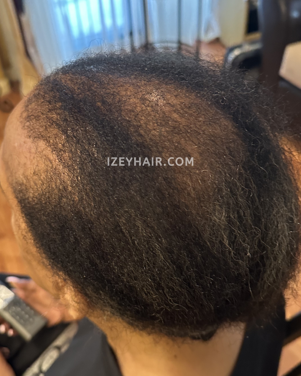 Human Hair Crochet Braids to conceal Alopecia