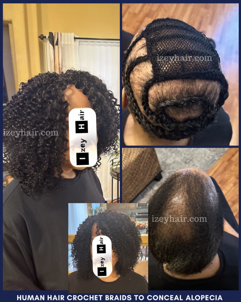 Human Hair Crochet Braids to conceal Alopecia