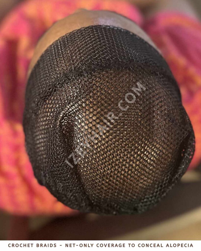 Crochet Braids - Net-Only Coverage to Conceal Alopecia