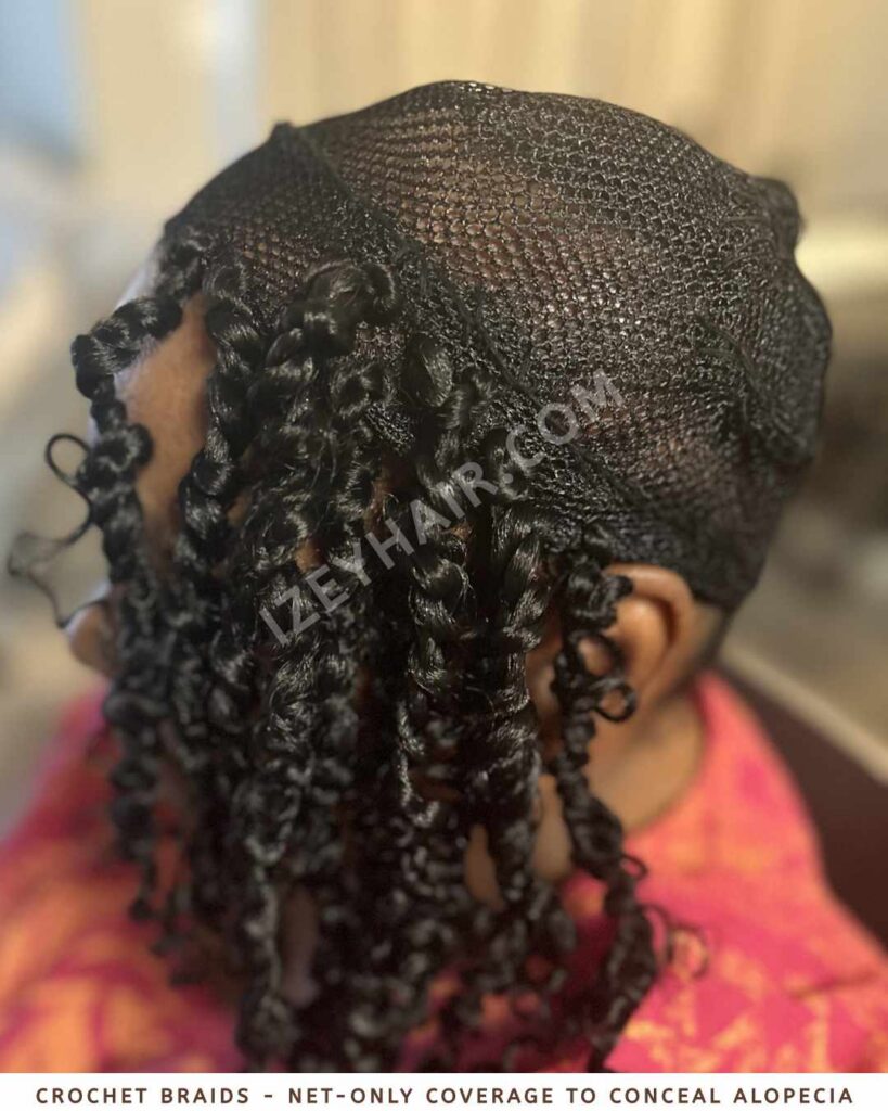 Crochet Braids - Net-Only Coverage to Conceal Alopecia