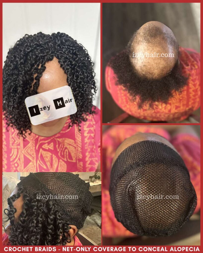 Crochet Braids - Net-Only Coverage to Conceal Alopecia