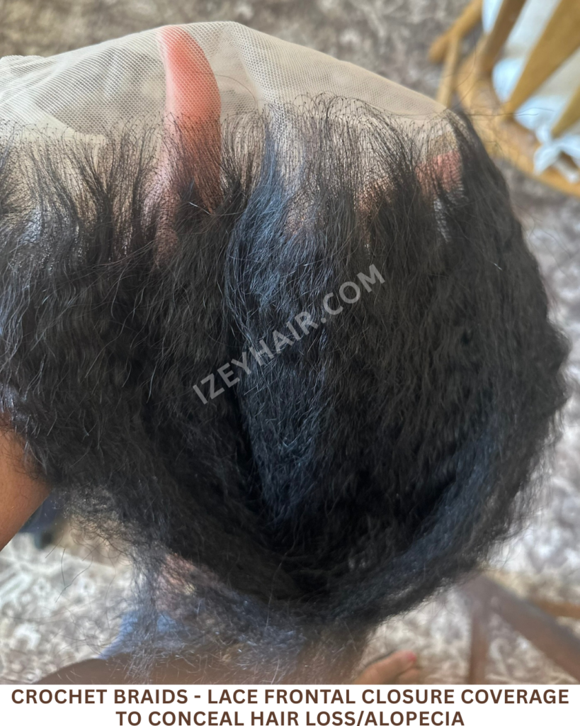 Crochet Braids - LACE FRONTAL CLOSURE coverage to conceal HAIR LOSS Alopecia