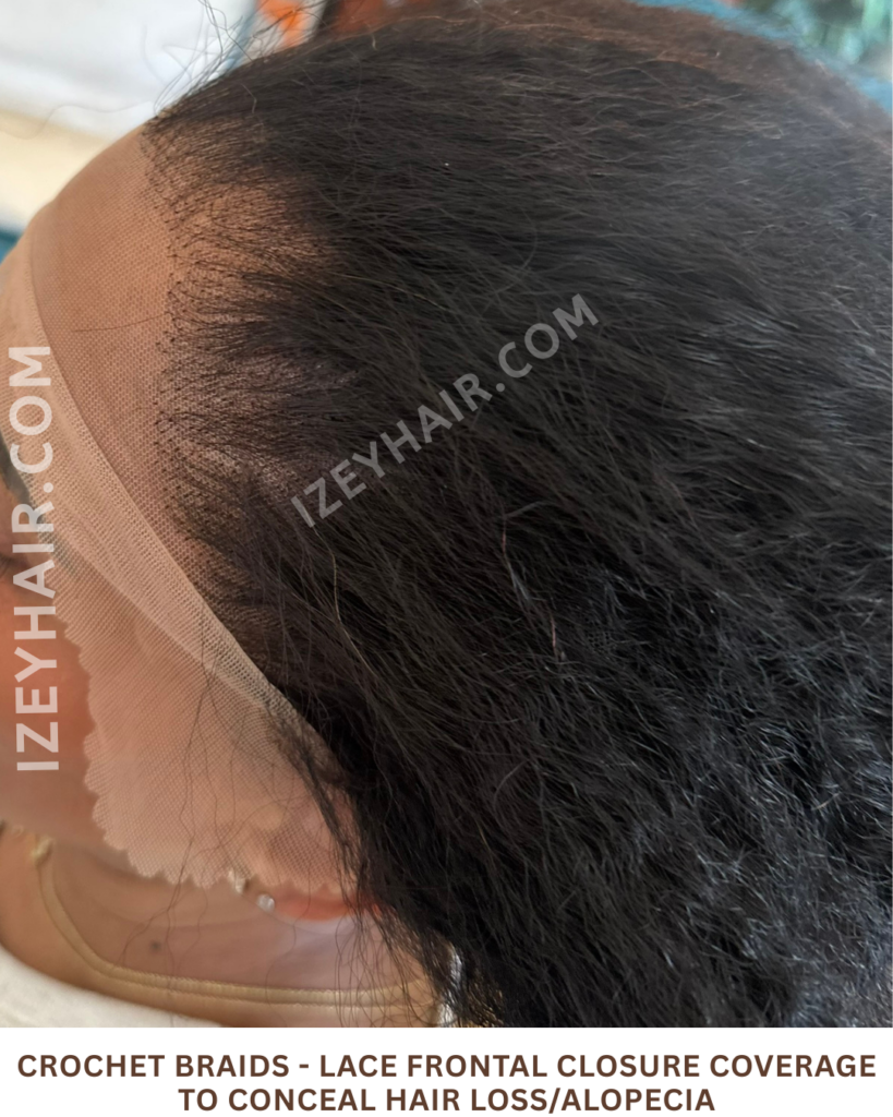 Crochet Braids - LACE FRONTAL CLOSURE coverage to conceal HAIR LOSS Alopecia