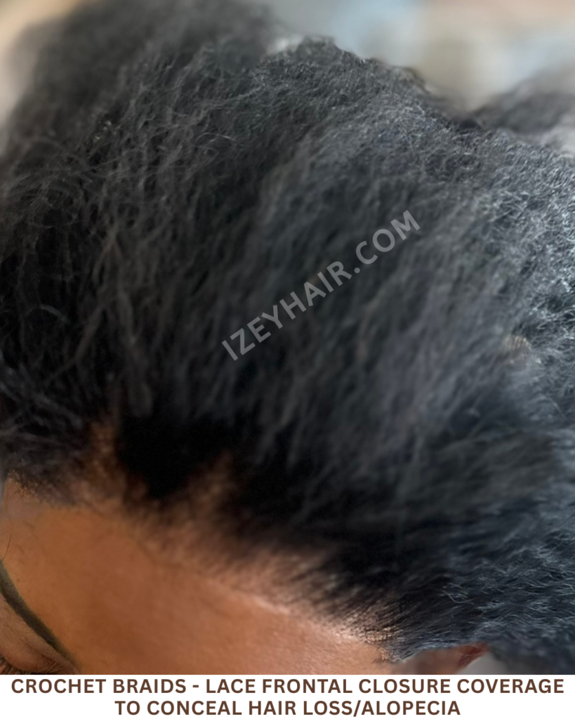 Crochet Braids - LACE FRONTAL CLOSURE coverage to conceal HAIR LOSS Alopecia