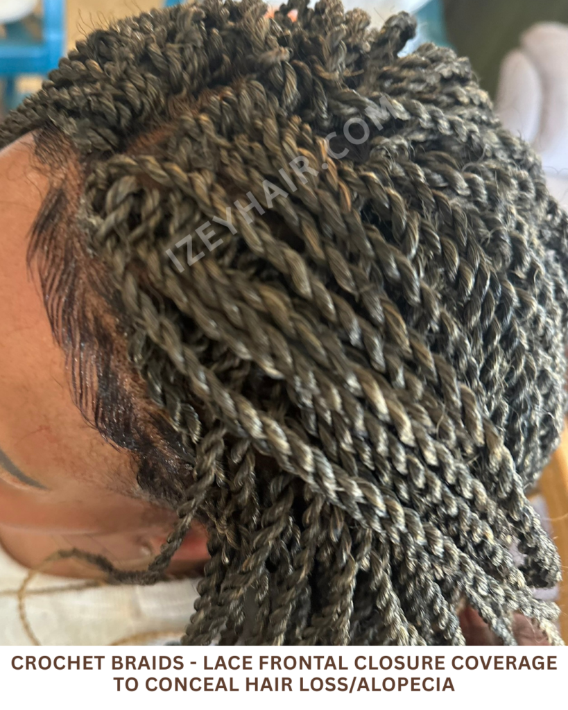 Crochet Braids - LACE FRONTAL CLOSURE coverage to conceal HAIR LOSS Alopecia